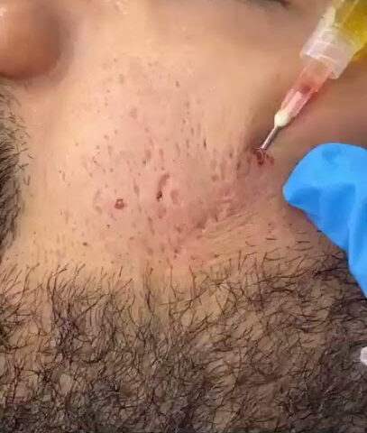 الدكتورة شيماء منصور | جلدية وتجميل وليزر بجدة - جدة - +966 54 427 4878