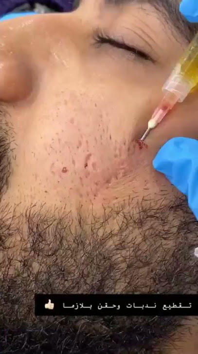 الدكتورة شيماء منصور | جلدية وتجميل وليزر بجدة - Jeddah 23425