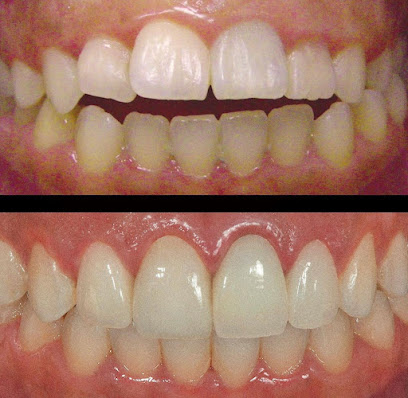 معمل كسب للاسنان معمل اسنان - جدة - +966 54 545 3601